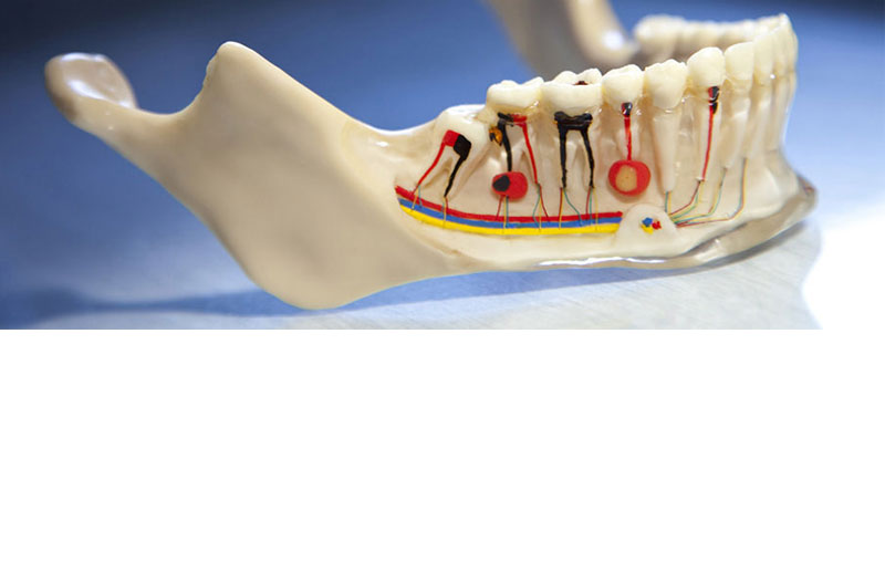 endodonti