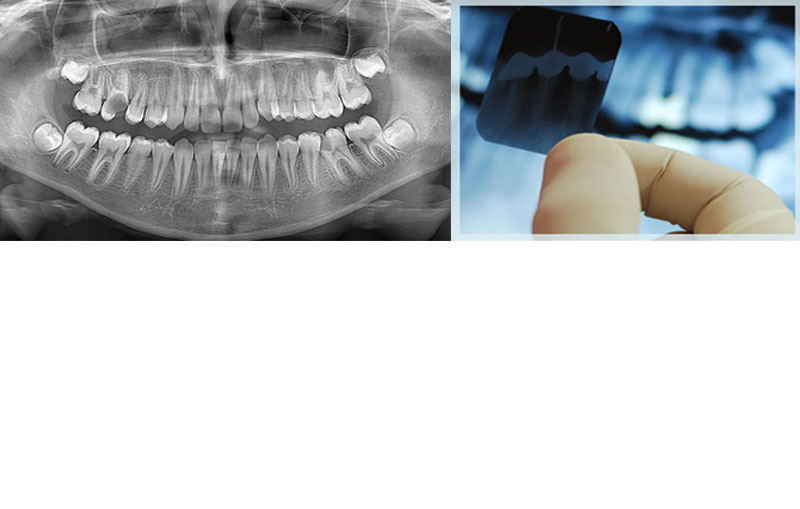 oral diagnoz radyoloji